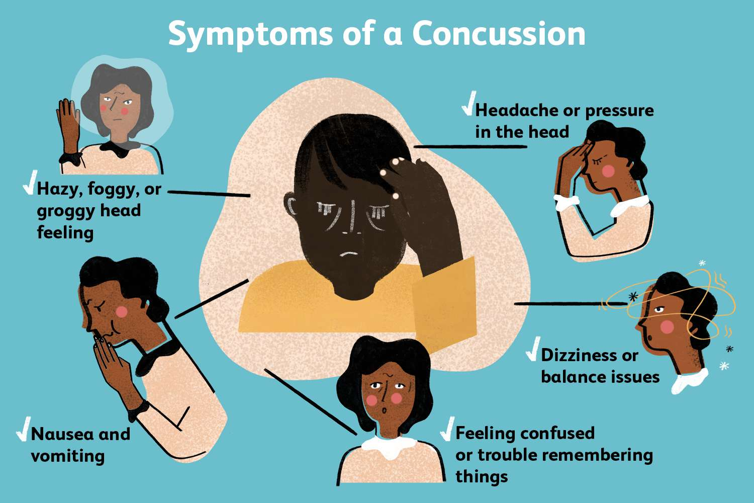 Symptoms of a Concussion What You Need to Know (2023)